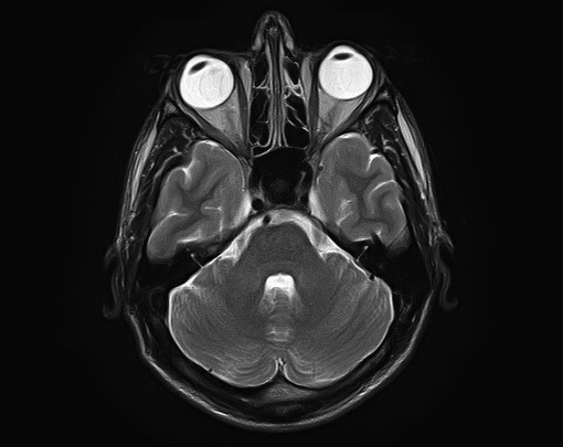 MRI Brain Scan Image - Mapping the Human Body - Atlas Obscura & Nat Geo